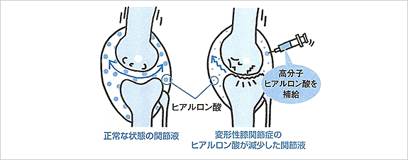 膝関節におけるヒアルロン酸の働き